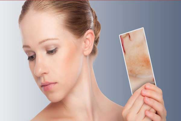Phương pháp chăm sóc và bảo vệ da nhạy cảm