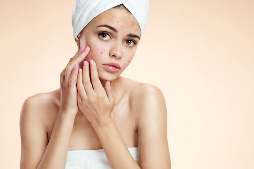 Phương pháp chăm sóc da sau mụn tại nhà