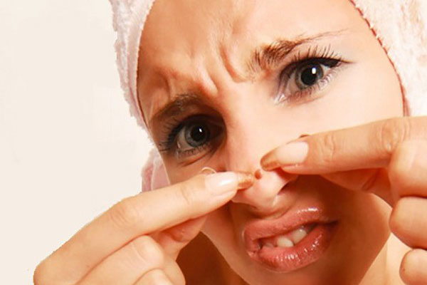 Mụn nổi vùng tam giác trên mặt có thật sự nguy hiểm như lời đồn?