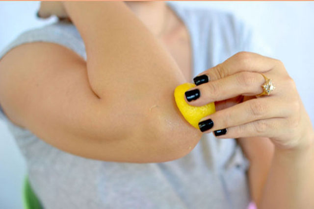 6 cách trị thâm khủy tay ngay tại nhà