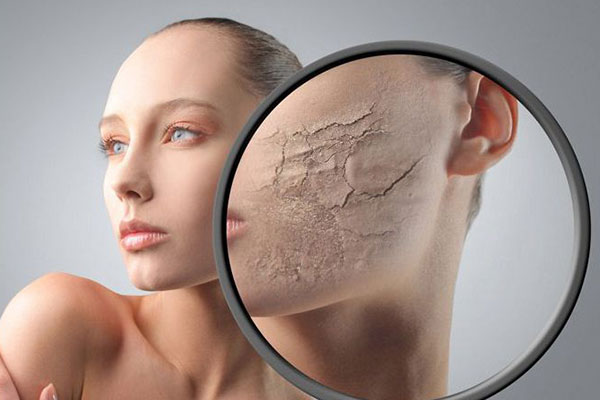 Da bị khô theo thời gian, nguyên nhân do đâu? (Phần 2)
