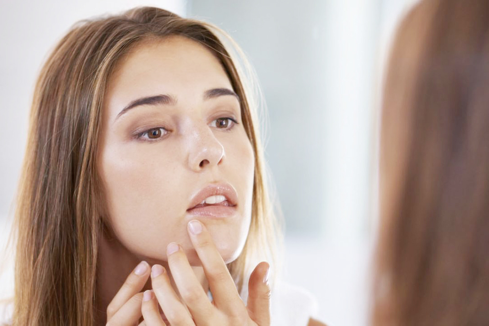 Mụn trứng cá: Mỗi độ tuổi đều có nguyên nhân và cách giải quyết khác nhau