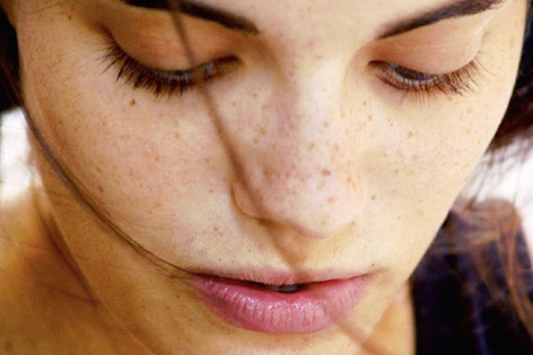 6 sự thật ít ai biết về đốm lão hóa (dark spot)