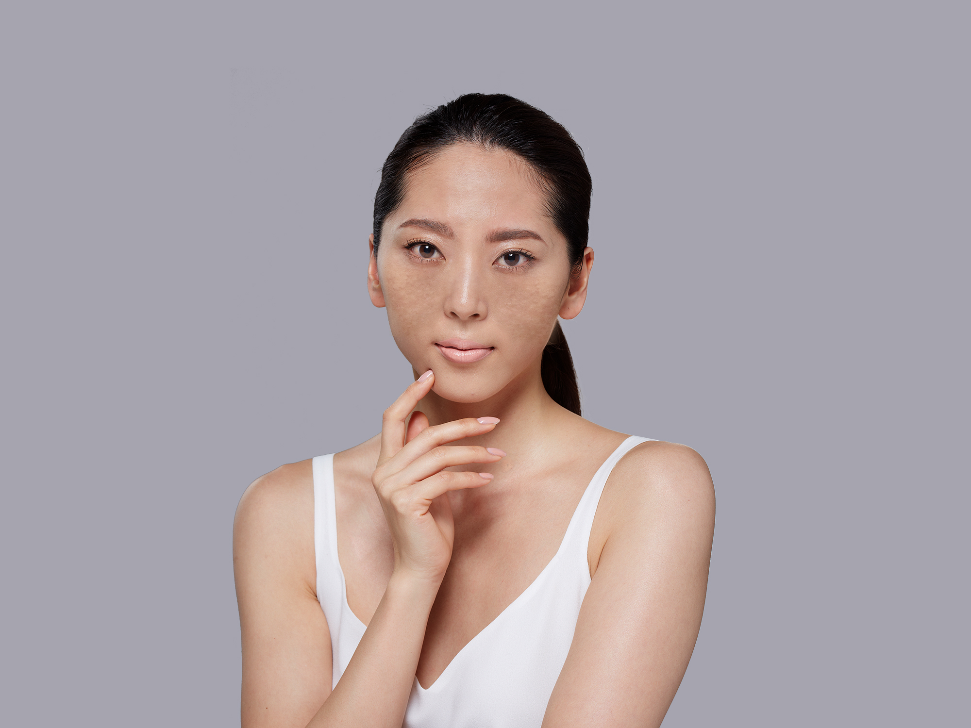 Bác sĩ Bạch Sương chia sẻ nguyên nhân khiến da sạm nám