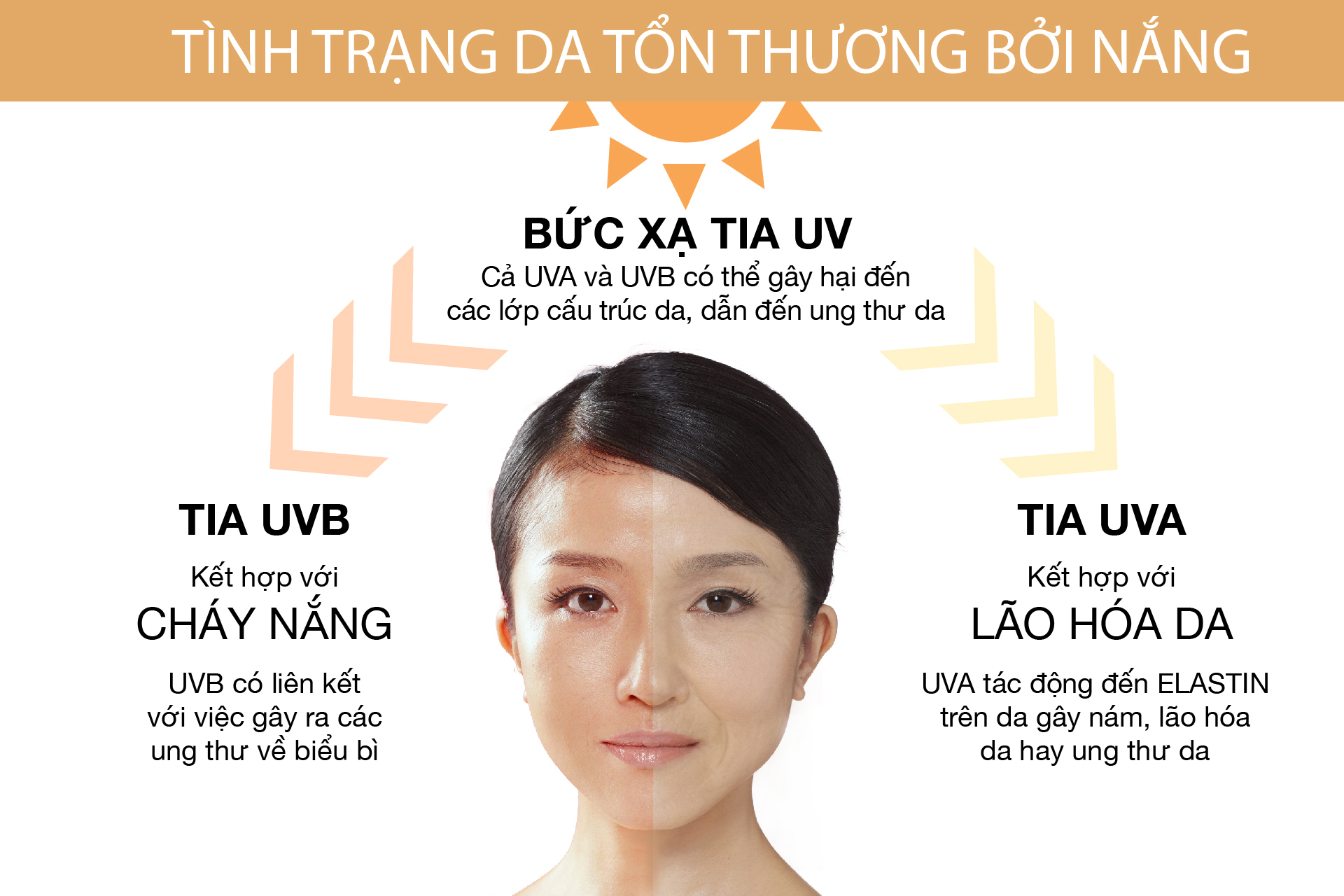 Vì sao phụ nữ Việt dễ bị nám đến vậy?
