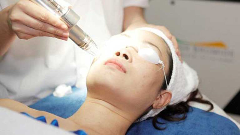 Lưu ý điều gì khi chọn lựa phương pháp thẩm mỹ giảm nám?